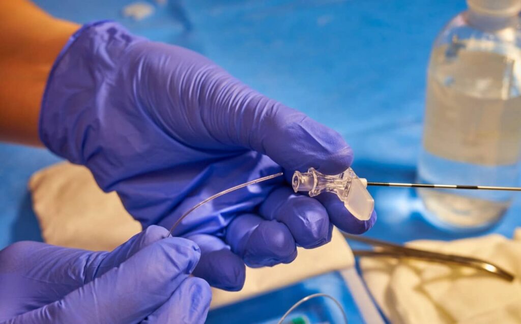 En que consiste la Anestesia Epidural en el parto procedimiento anestesia epidural en el parto